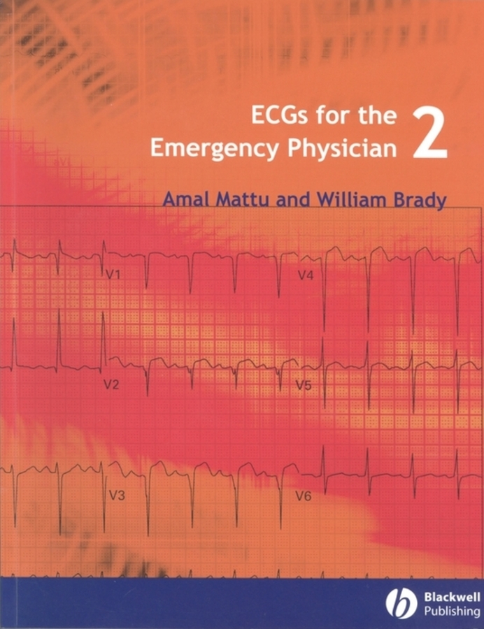 Brady William J. ECGs for the Emergency Physician 2