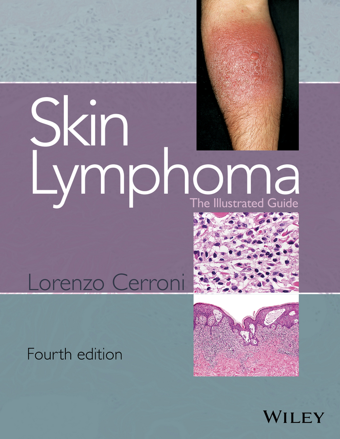 Lorenzo Cerroni Skin Lymphoma. The Illustrated Guide