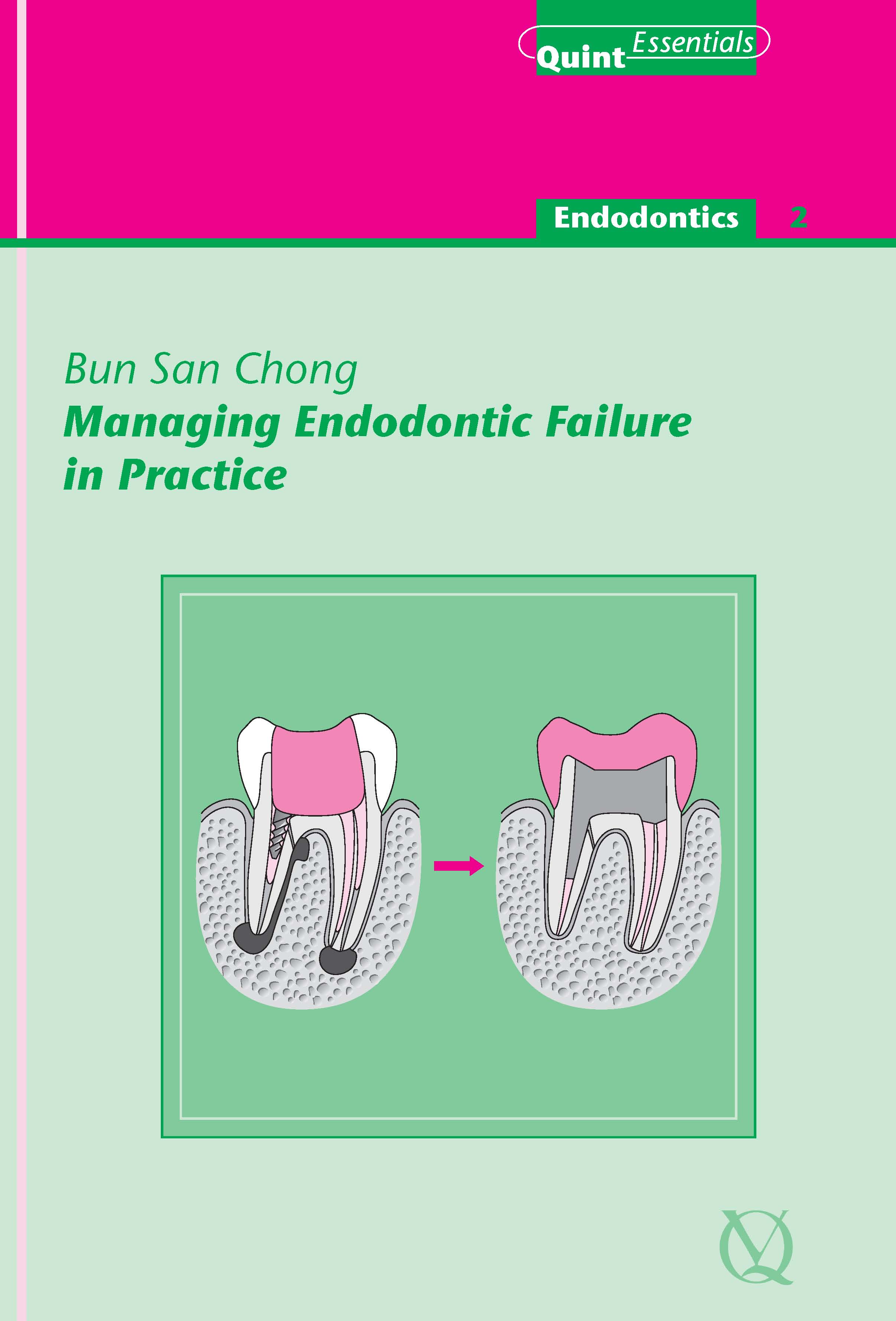 Managing Endodontic Failure in Practice