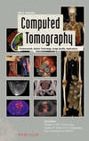 Computed Tomography. Fundamentals, System Technology, Image Quality, Applications