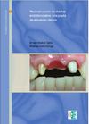 Reconstrucción de dientes endodonciados