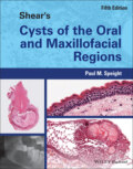 Shear\'s Cysts of the Oral and Maxillofacial Regions