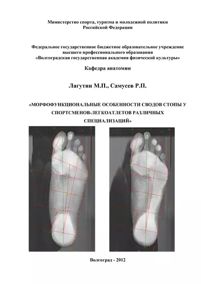 Обложка книги Морфофункциональные особенности сводов стопы у спортсменов-легкоатлетов различных специализаций, Р. П. Самусев