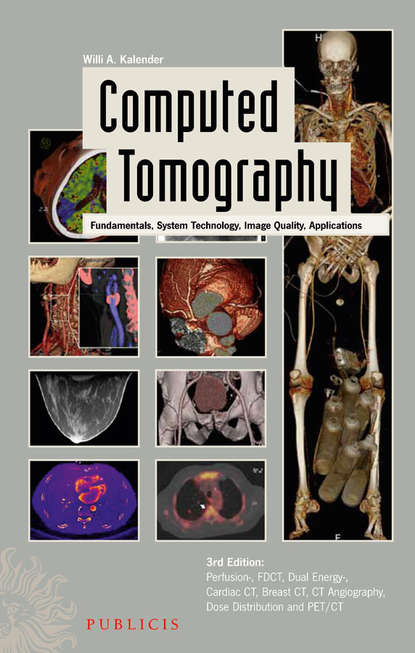 Willi Kalender A. — Computed Tomography. Fundamentals, System Technology, Image Quality, Applications