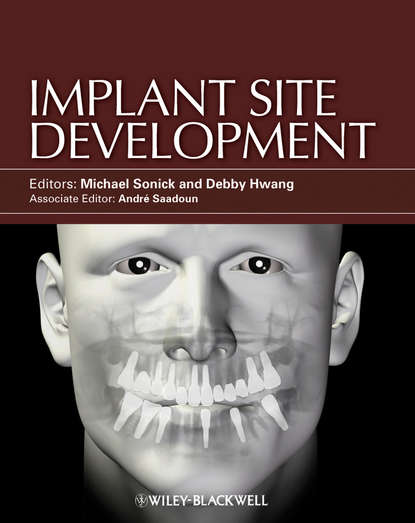 Implant Site Development (Sonick Michael). 