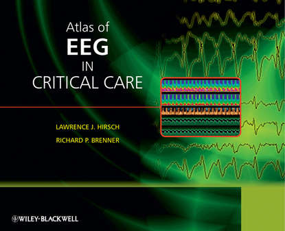 Brenner Richard - Atlas of EEG in Critical Care