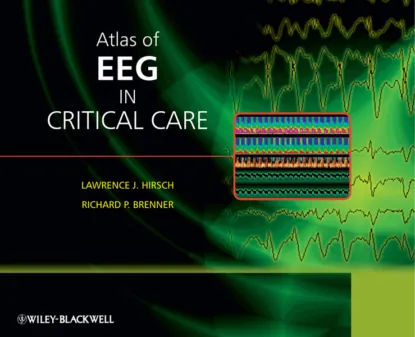 Обложка книги Atlas of EEG in Critical Care, Brenner Richard