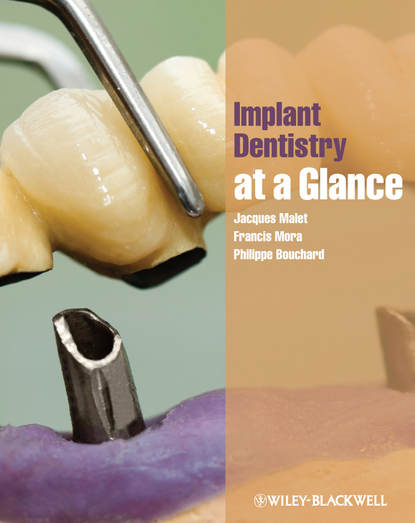 Jacques Malet - Implant Dentistry at a Glance