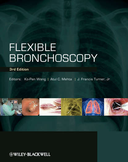 

Flexible Bronchoscopy