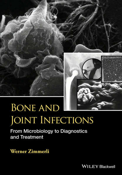 W. Zimmerli Bone and Joint Infections. From Microbiology to Diagnostics and Treatment bacterial contaminated stethoscopes a source of nosocomial infections