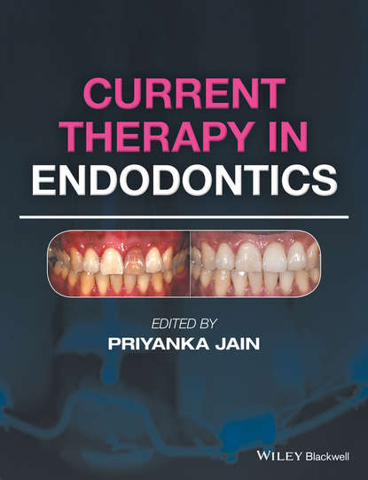 Группа авторов - Current Therapy in Endodontics