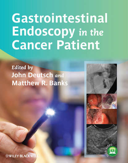Gastrointestinal Endoscopy in the Cancer Patient - Группа авторов
