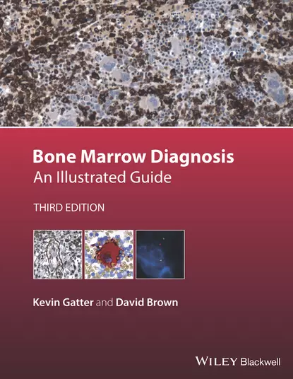 Обложка книги Bone Marrow Diagnosis, David Brown