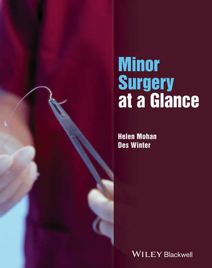 Minor Surgery at a Glance - Helen Mohan