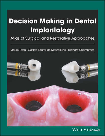 Decision Making in Dental Implantology - Mauro Tosta