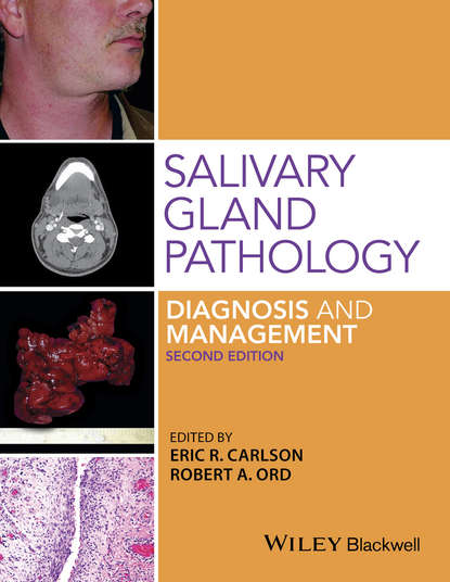Salivary Gland Pathology (Eric R. Carlson). 