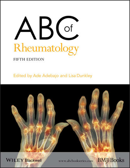 Ade  Adebajo - ABC of Rheumatology