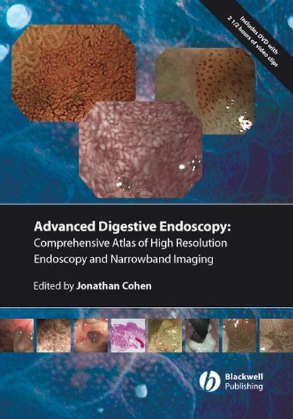 Comprehensive Atlas of High Resolution Endoscopy and Narrowband Imaging - Группа авторов