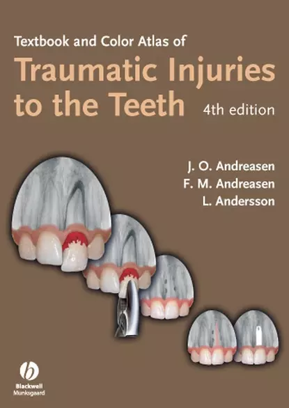 Обложка книги Textbook and Color Atlas of Traumatic Injuries to the Teeth, Lars  Andersson