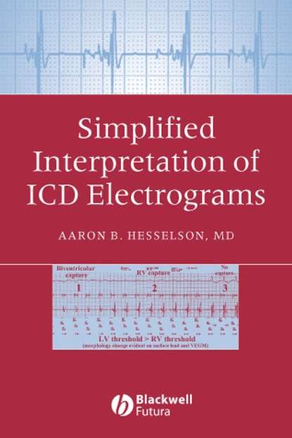 Группа авторов - Simplified Interpretation of ICD Electrograms