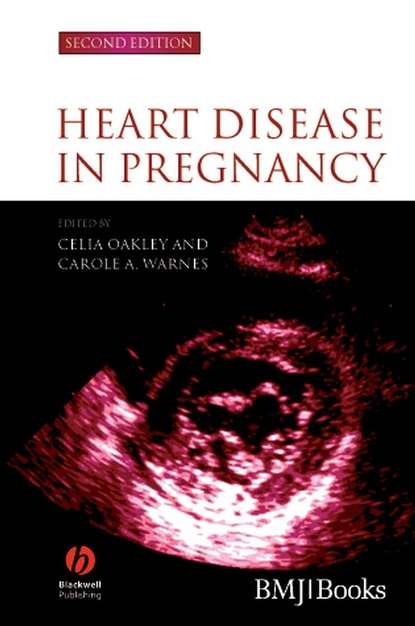 Celia  Oakley - Heart Disease in Pregnancy