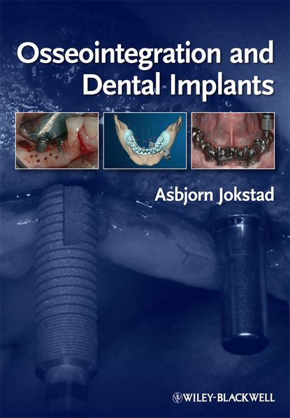 Osseointegration and Dental Implants - Группа авторов