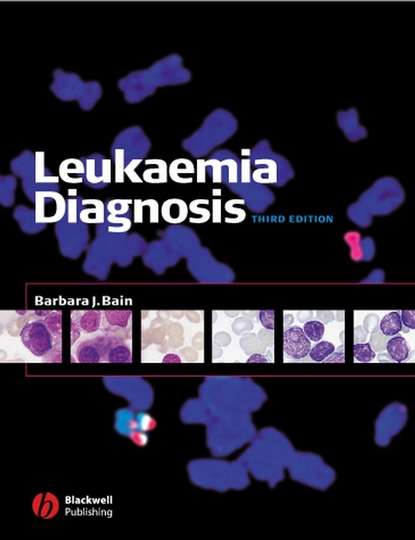 Группа авторов - Leukaemia Diagnosis
