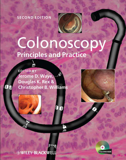 Colonoscopy - Christopher Williams B.