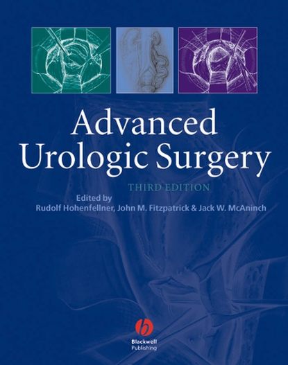 Jack  McAninch - Advanced Urologic Surgery