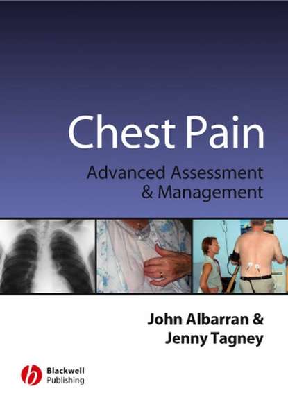 John  Albarran - Chest Pain