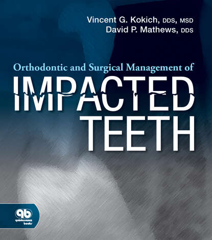 Vincent G. Kokich - Orthodontic and Surgical Management of Impacted Teeth