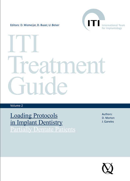 

Loading Protocols in Implant Dentistry