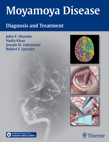 Группа авторов - Moyamoya Disease