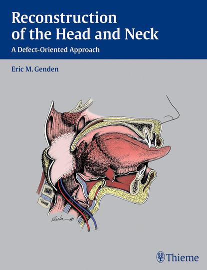 Eric M. Genden - Reconstruction of the Head and Neck