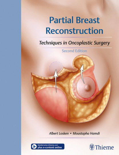 Группа авторов - Partial Breast Reconstruction