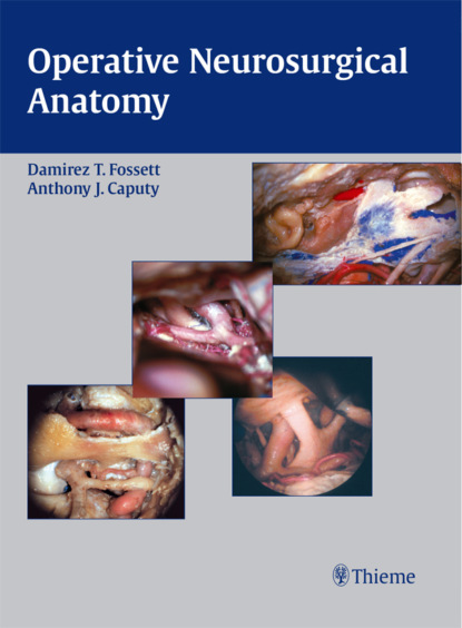 Damirez T. Fossett - Operative Neurosurgical Anatomy