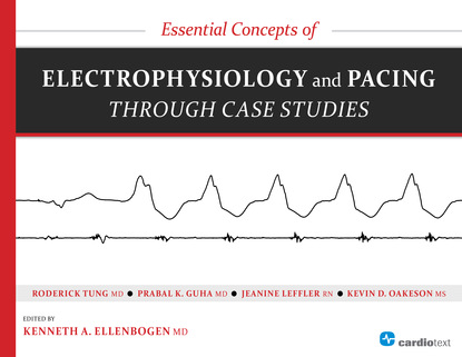 Roderick Tung - Essential Concepts of Electrophysiology and Pacing through Case Studies