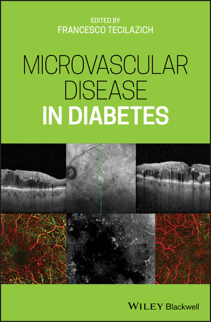 Группа авторов - Microvascular Disease in Diabetes