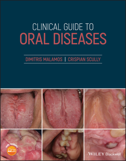 Crispian Scully - Clinical Guide to Oral Diseases