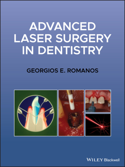 Advanced Laser Surgery in Dentistry (Georgios E. Romanos). 
