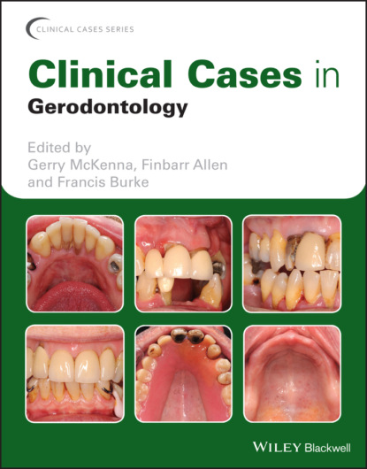 Группа авторов - Clinical Cases in Gerodontology