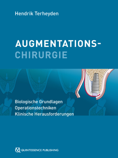 Augmentationschirurgie (Hendrik Terheyden). 