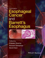 Esophageal Cancer and Barrett\'s Esophagus